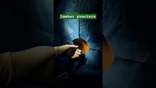 Lumbar puncture lumbarpuncture lumbarpunctureprocedure TechhealthOT [upl. by Koralie]