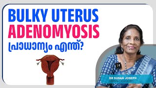 Adenomyosis  Is it problematic  Bulky uterus ADENOMYOSIS പ്രാധാന്യം എന്ത്  DRSUSAN JOSEPH [upl. by Greenwald]