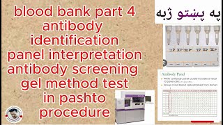 antibody identification panel  antibody screening gel method  blood bank part 4  in pashto [upl. by Clift]