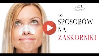 10 domowych sposobów na zaskórniki  Naturalne metody na wągry  cz1 [upl. by Nnahs]