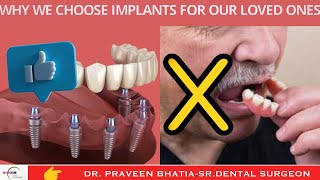 Dental implants for you loved oneWhy to chooseMajor benefits of implants dentalimplants [upl. by Nylirad]