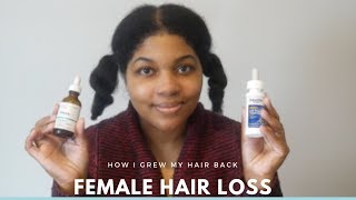 FEMALE HAIR LOSS  How I Grew My Hair Back  UPDATE [upl. by Dall]