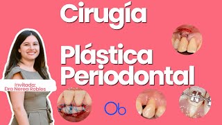 Cirugía Plástica Periodontal con Dra Nerea Robles [upl. by Donohue537]