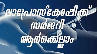 ലാപ്രോസ്കോപ്പിക് സർജറി ആ൪ക്കെല്ലാംWho can opt Laparoscopic surgery  Dr Mareena  Arogyavicharam [upl. by Kling440]