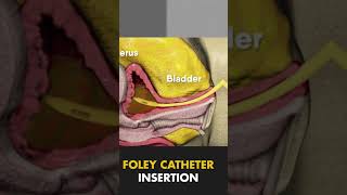 FOLEY CATHETER INSERTION How To Insert A Foley Catheter Male [upl. by Aaron]