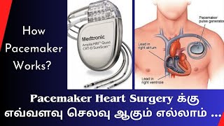 how pacemaker works  Heart charging machine  Pacemaker life expectancy  Breathing machine [upl. by Furlani]