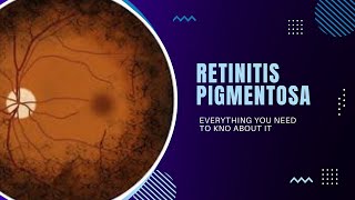 Retinitis Pigmentosa  Genetics Pathophysiology Signs amp Symptoms Diagnosis Treatment [upl. by Asreht]