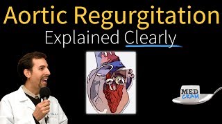 Aortic Regurgitation Insufficiency Explained Clearly [upl. by Coucher]