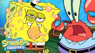 Is SpongeBob Allergic To Krabby Patties 😱 quotAllergy Attackquot Full Scene  SpongeBob [upl. by Edwyna948]