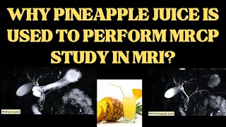 MRCP study main pineapple juice ka use kyun karte hain  why do we use pineapple juice in MRCP study [upl. by Ttirb]