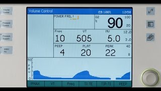 Dräger Fabius plus XL  Safety features [upl. by Jarv]