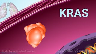 Understanding NSCLC Treatment When You Have a KRAS Mutation [upl. by Nahtanod]