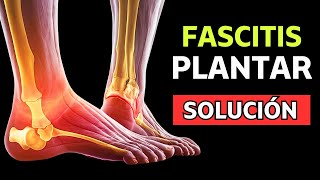 ⛔ Descubre Cómo ELIMINAR la FASCITIS PLANTAR en POCOS DÍAS  MÉTODO PROBADO ✅ [upl. by Barnett]