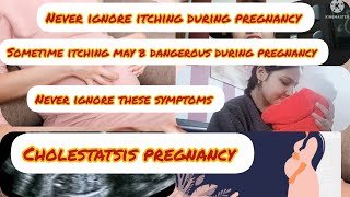 ITCHING DURING PREGNANCY 😑 MY EXPERIENCE WITH CHOLESTASIS OF PREGNANCYitchingduringpregnancy [upl. by Rosamund]