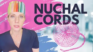 Nuchal cords during pregnancy and childbirth and complications [upl. by Alilad]