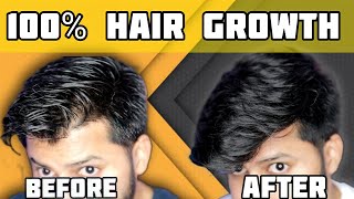 Best Hair Growth Technique  இத follow பண்ணா கண்டிப்பா முடி வளரும்  Tamil  Shadhik Azeez [upl. by Gilda797]