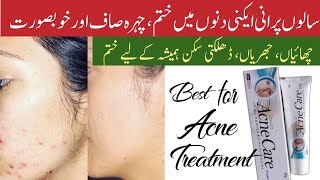 acne care cream  davis acne care cream  acne care cream review  acne ka ilaj  acnetreatment [upl. by Branham970]