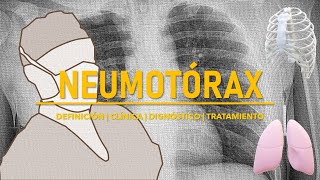 NEUMOTÓRAX  Definición Clasificación Anatomía Tratamiento Pronóstico [upl. by Irrep]