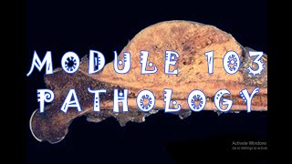 1 intracellular accumulations and extracellular depositions part 1 pathology dr faisal module 103 [upl. by Eelatan792]