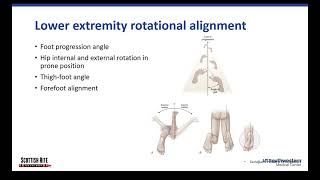 Lower Extremity Alignment [upl. by Annaoj141]