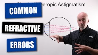 Common Refractive Errors Of The Human Eye [upl. by Eyar]