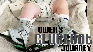 Baby Owens Clubfoot Journey  Pangani Tribe [upl. by Tam]