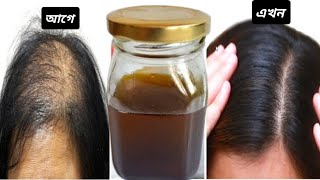 আমলকির তেল তৈরি করে টাক মাথায় চুল গজাও  Amla hair oil for fast hair growth  আমলকির তেল তৈরীর নিয়ম [upl. by Nocaj730]