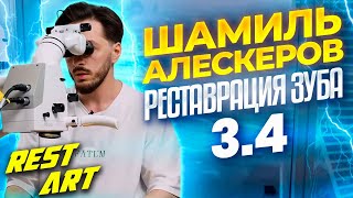 Реставрация зуба 34  Шамиль Алескеров  RestART [upl. by Attaymik]