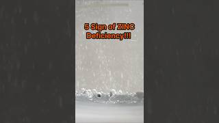 5 Signs of ZINC Deficiency and How to Fix it health zinc shorts [upl. by Eanod]