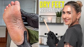 Restoring Dry Cracked Feet And Heels SATISFYING [upl. by Eiramlatsyrc]