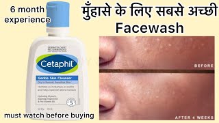 Full Review in Hindi Cetaphil Face Cleanser cetaphilcleanser cetaphilgentleskincleanser cetaphil [upl. by Oileduab726]