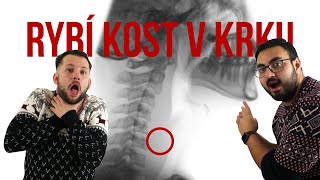 RYBÍ KOST V KRKU  jak postupovat [upl. by Meredeth612]