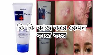 Mistine acne clear facewash review  ফেশওয়াস টি আসলে কেমন সত্যি কি ব্রন কমাতে সাহায্য করে [upl. by Hynda]