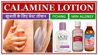 CALAMINE LOTION BEST LOTION FOR ITCHING SKIN ALLERGY खुजली के लिए बेस्ट लोशन MEDICATED LOTION [upl. by Samantha]