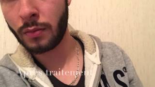 Faire pousser sa barbe avec Beardilizer [upl. by Balthasar]