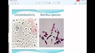 13gram positive bacilli [upl. by Carpenter]