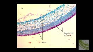 ORGANISM SLIDE Peziza [upl. by Refynnej544]