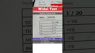 Widal Test tcml mbbs shorts [upl. by Valle]