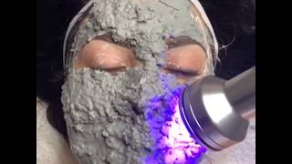 BEST PEEL OFF MASK  HYDRAFACIAL MD [upl. by Fabio887]