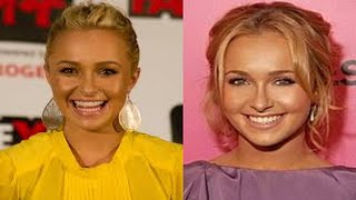 Sad News For Singer Hayden Panettiere She Is Confirmed To Be [upl. by Atinas]