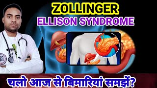 Whats Zollinger Ellison Syndrome ZES DISEASE  SYMPTOMS OF ZES  DISEASES [upl. by Irak988]