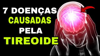 7 DOENÇAS CAUSADAS PELA TIREOIDE Hipotireoidismo e Hipertireoidismo [upl. by Now]