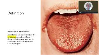 XEROSTOMIA TREATING DRY MOUTH TO IMPROVE PATIENT OUTCOMES [upl. by Htenywg840]