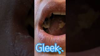 Gleek mouthsounds gleek [upl. by Htenek]