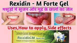 Rexidin m forte gel। मुंह के छालों का जेल। rexidin m forte gel how to use। mouth ulcer gel। [upl. by Gyimah]