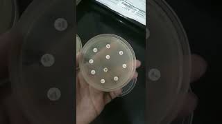 lawn culture antibiotic sensitivity test medical medico microbiology [upl. by Yatnwahs5]