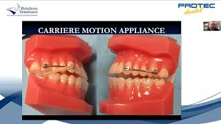 WEBINAR Carriere Motion Appliance [upl. by Anigriv]