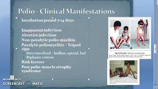 Microbiology 494 c PolioMyelitis Clinical Features Polio [upl. by Werner450]