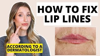 How to Fix Lip Lines  Dermatologist Shares Treatments for Lip Wrinkles [upl. by Benoit]