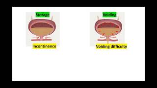 Urodynamic study  summary of TOG [upl. by Giess]